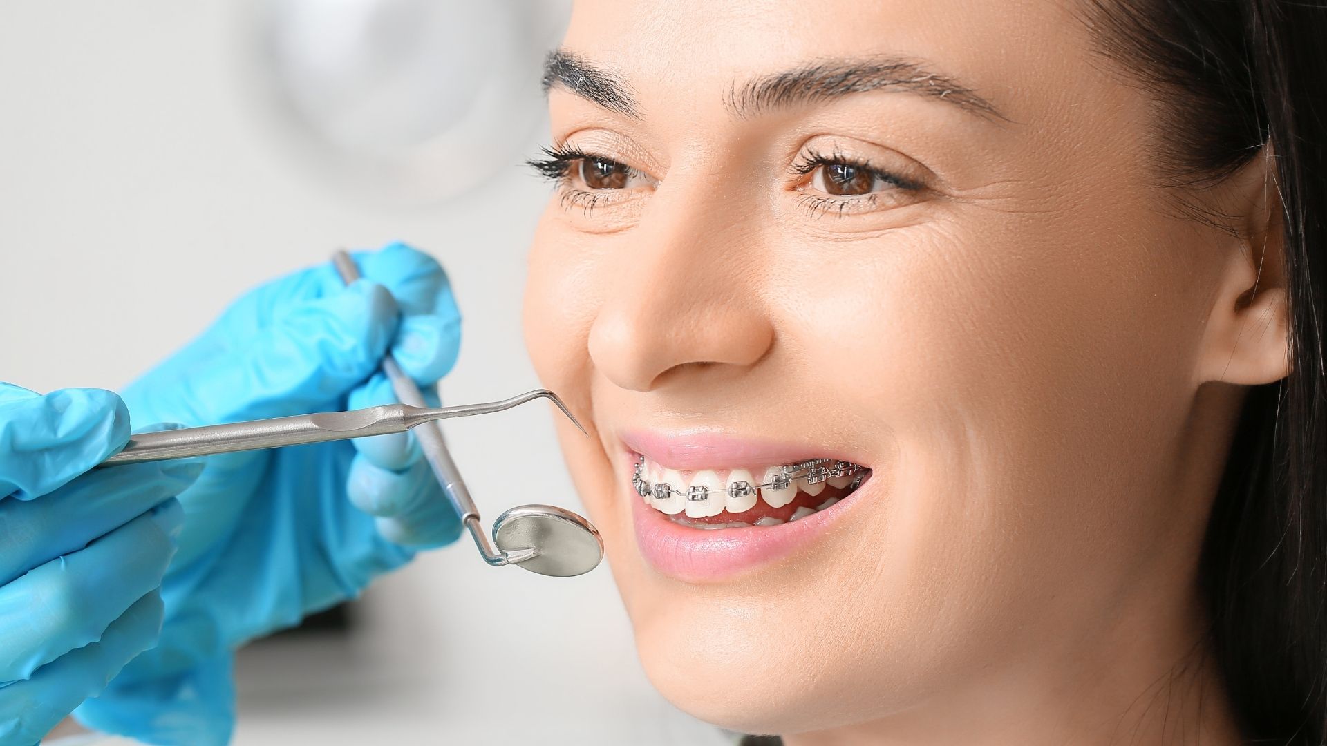 Dental Braces in Vashi Navi Mumbai