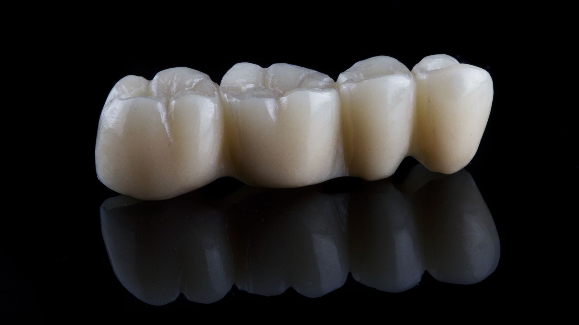 Dental Crowns in Vashi Navi Mumbai
