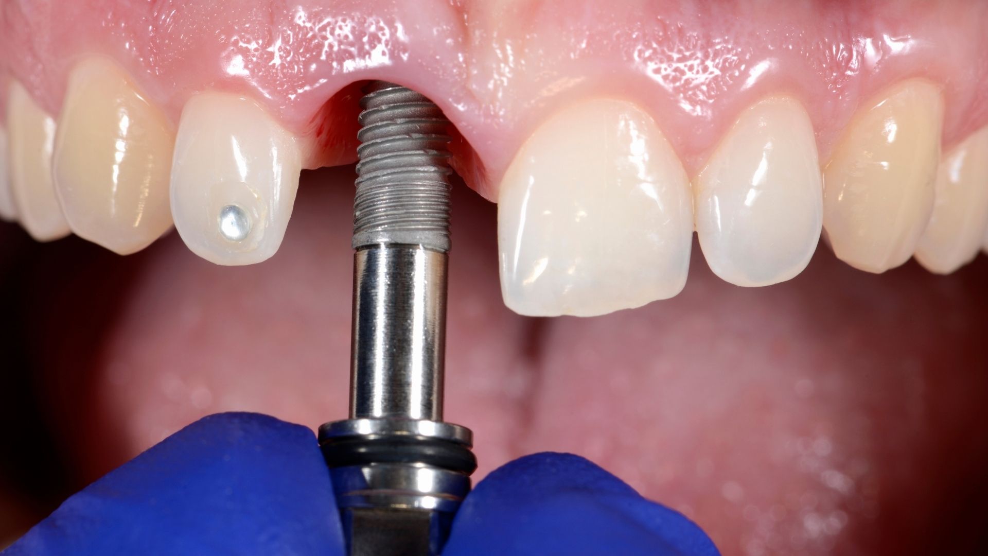 RCT in Vashi Navi Mumbai