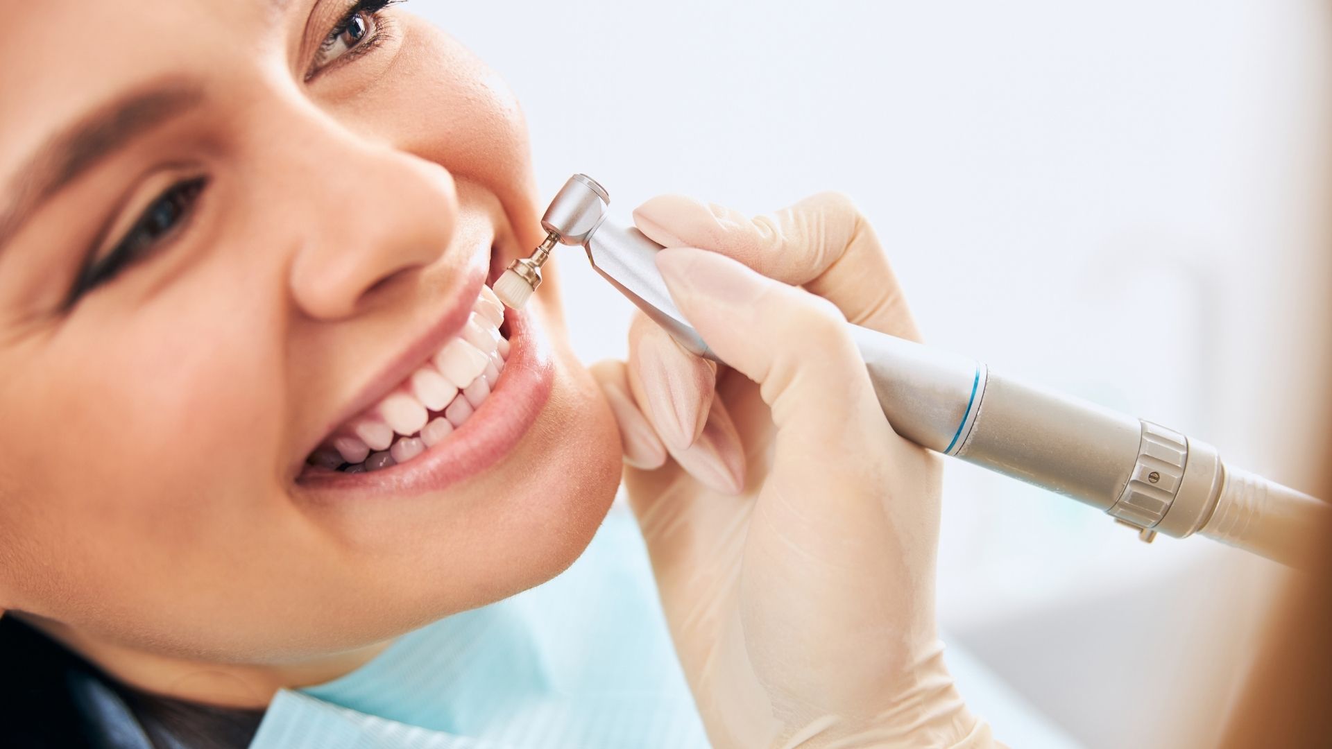 Teeth Whitening in Vashi Navi Mumbai
