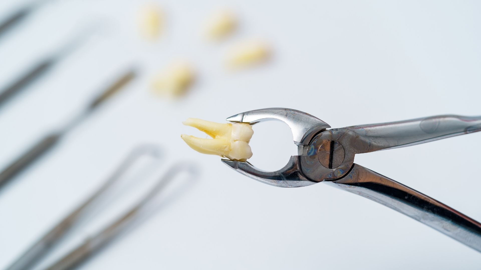 Tooth Extraction in Vashi Navi Mumbai