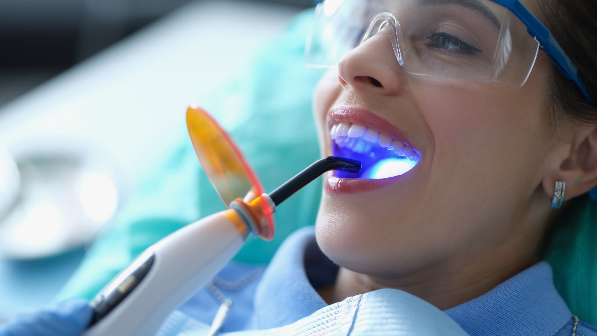 Tooth Colored Fillings in Vashi Navi Mumbai
